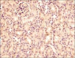Invitrogen SEMA3B Polyclonal Antibody 50 &mu;L | Buy Online | Invitrogen&trade; | Fisher Scientific