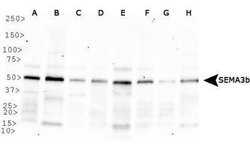 Invitrogen SEMA3B Polyclonal Antibody 50 &mu;L | Buy Online | Invitrogen&trade; | Fisher Scientific