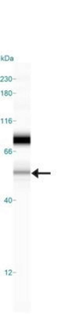 Invitrogen SEMA3B Polyclonal Antibody 50 &mu;L | Buy Online | Invitrogen&trade; | Fisher Scientific