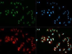 Invitrogen HP1 alpha Polyclonal Antibody 100 &mu;L; Unconjugated:Antibodies,