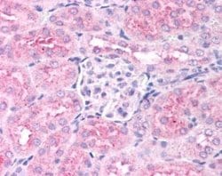 Invitrogen PHD2 Polyclonal Antibody 100 &mu;L; Unconjugated:Antibodies,