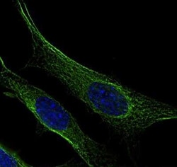 Invitrogen beta Tubulin Polyclonal Antibody 100 &mu;L | Buy Online | Invitrogen&trade; | Fisher Scientific