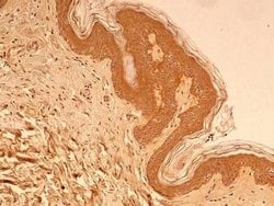 Invitrogen beta Tubulin Polyclonal Antibody 100 &mu;L; Unconjugated:Antibodies,