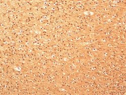 Invitrogen beta Tubulin Polyclonal Antibody 100 &mu;L; Unconjugated:Antibodies,