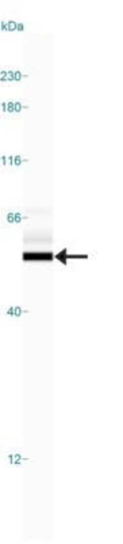 Invitrogen beta Tubulin Polyclonal Antibody 100 &mu;L; Unconjugated:Antibodies,