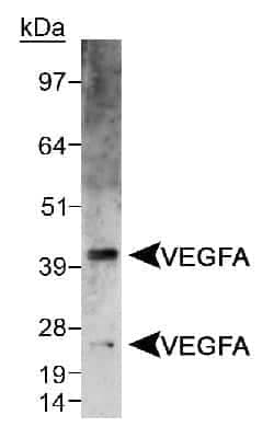 Invitrogen VEGF Polyclonal Antibody 100 &mu;L | Buy Online | Invitrogen&trade; | Fisher Scientific