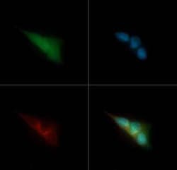 Invitrogen&trade;&nbsp;CRYAB Polyclonal Antibody