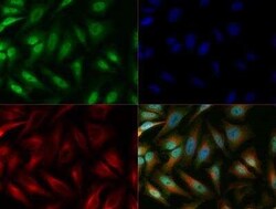 Invitrogen LOX Polyclonal Antibody 50 &mu;L | Buy Online | Invitrogen&trade; | Fisher Scientific