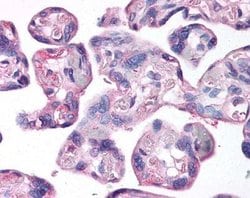 Invitrogen LOX Polyclonal Antibody 50 &mu;L; Unconjugated:Antibodies, Polyclonal