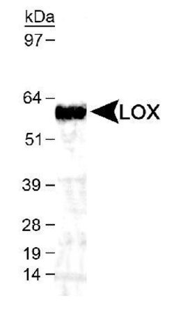 Invitrogen LOX Polyclonal Antibody 50 &mu;L; Unconjugated:Antibodies, Polyclonal