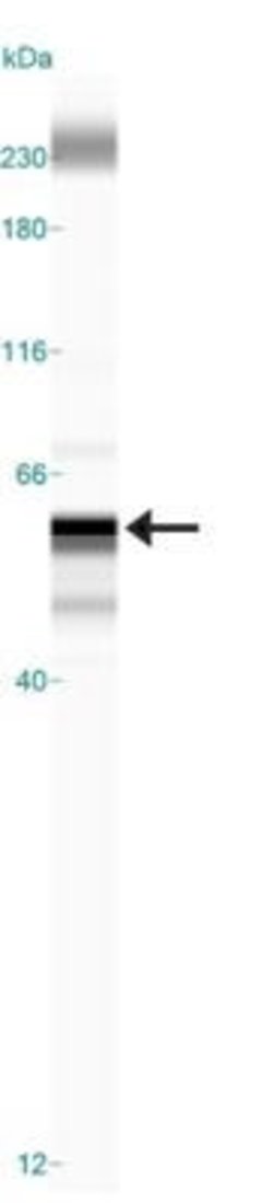 Invitrogen LOX Polyclonal Antibody 50 &mu;L; Unconjugated:Antibodies, Polyclonal
