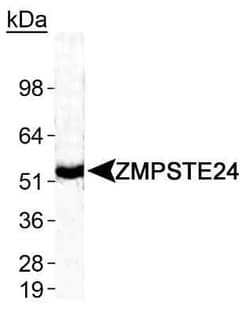 Invitrogen ZMPSTE24 Polyclonal Antibody 100 &mu;L | Buy Online | Invitrogen&trade; | Fisher Scientific