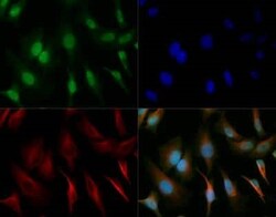 Invitrogen SOX2 Polyclonal Antibody 100 &mu;L | Buy Online | Invitrogen&trade; | Fisher Scientific