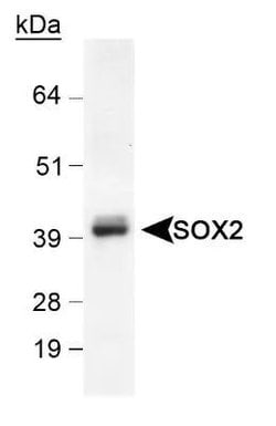 Invitrogen SOX2 Polyclonal Antibody 100 &mu;L | Buy Online | Invitrogen&trade; | Fisher Scientific