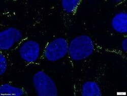 Invitrogen ADFP Polyclonal Antibody 100 &mu;L | Buy Online | Invitrogen&trade; | Fisher Scientific