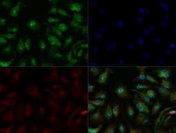 Invitrogen ADFP Polyclonal Antibody 100 &mu;L | Buy Online | Invitrogen&trade; | Fisher Scientific