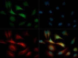 Invitrogen GPIHBP1 Polyclonal Antibody 100 &mu;L | Buy Online | Invitrogen&trade; | Fisher Scientific