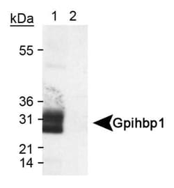 Invitrogen GPIHBP1 Polyclonal Antibody 100 &mu;L | Buy Online | Invitrogen&trade; | Fisher Scientific