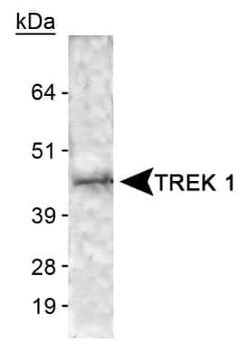 Invitrogen KCNK2 Polyclonal Antibody 100 &mu;L | Buy Online | Invitrogen&trade; | Fisher Scientific