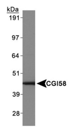 Invitrogen CGI58 Polyclonal Antibody 100 &mu;L; Unconjugated:Antibodies,