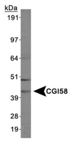 Invitrogen CGI58 Polyclonal Antibody 100 &mu;L; Unconjugated:Antibodies,