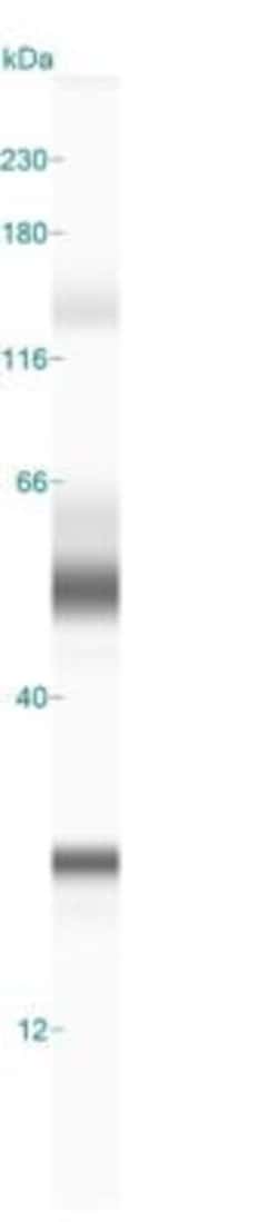 Invitrogen CGI58 Polyclonal Antibody 100 &mu;L; Unconjugated:Antibodies,