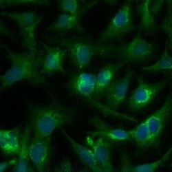 Invitrogen DGAT1 Polyclonal Antibody 100 &mu;L | Buy Online | Invitrogen&trade; | Fisher Scientific