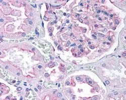 Invitrogen DNM1L Polyclonal Antibody 100 &mu;L; Unconjugated:Antibodies,