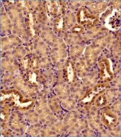 Invitrogen DNM1L Polyclonal Antibody 100 &mu;L; Unconjugated:Antibodies,