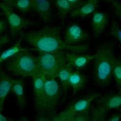 Invitrogen LOX Polyclonal Antibody 100 &mu;L | Buy Online | Invitrogen&trade; | Fisher Scientific