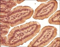 Invitrogen LOX Polyclonal Antibody 100 &mu;L; Unconjugated:Antibodies,