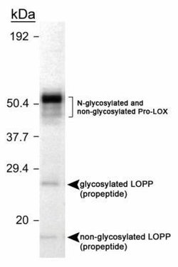 Invitrogen LOX Polyclonal Antibody 100 &mu;L; Unconjugated:Antibodies,