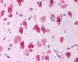 Invitrogen LRRK2 Polyclonal Antibody 100 &mu;L; Unconjugated:Antibodies,