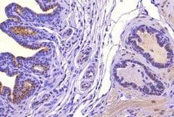 Invitrogen SAT1 Polyclonal Antibody 100 &mu;L; Unconjugated:Antibodies,