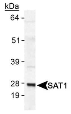 Invitrogen SAT1 Polyclonal Antibody 100 &mu;L; Unconjugated:Antibodies,