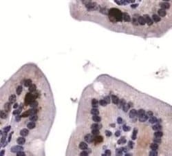 Invitrogen ATG9A Polyclonal Antibody 100 &mu;L; Unconjugated:Antibodies,