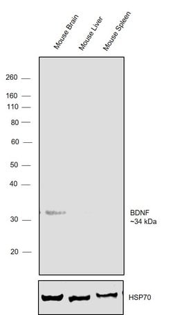 Invitrogen proBDNF Polyclonal Antibody 100 &mu;L | Buy Online | Invitrogen&trade; | Fisher Scientific