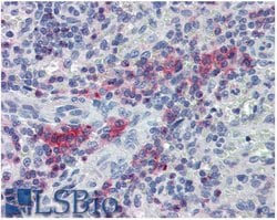 Invitrogen LIME Polyclonal Antibody 100 &mu;g; Unconjugated:Antibodies,