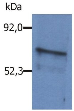 Invitrogen BLNK Polyclonal Antibody 100 &mu;g; Unconjugated:Antibodies,