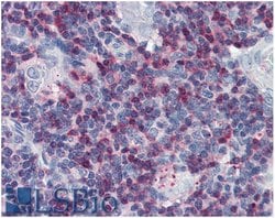 Invitrogen SLP76 Polyclonal Antibody 100 &mu;g; Unconjugated:Antibodies,