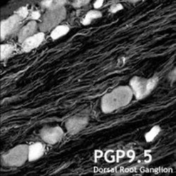 Invitrogen PGP9.5 Polyclonal Antibody 50 &mu;L; Unconjugated:Antibodies,