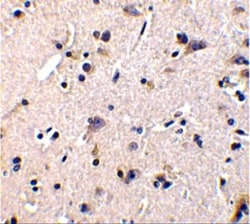 Invitrogen GFR alpha-1 Polyclonal Antibody 50 &mu;g; Unconjugated:Antibodies,