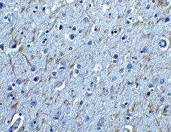 Invitrogen GFR alpha-1 Polyclonal Antibody 50 &mu;g; Unconjugated:Antibodies,