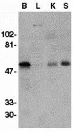 Invitrogen GFR alpha-1 Polyclonal Antibody 50 &mu;g; Unconjugated:Antibodies,