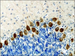 Invitrogen KIF3A Polyclonal Antibody 50 &mu;L; Unconjugated:Antibodies,