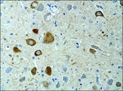 Invitrogen KIF3A Polyclonal Antibody 50 &mu;L; Unconjugated:Antibodies,