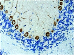 Invitrogen KIF3A Polyclonal Antibody 50 &mu;L; Unconjugated:Antibodies,