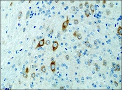 Invitrogen KIF3A Polyclonal Antibody 50 &mu;L; Unconjugated:Antibodies,