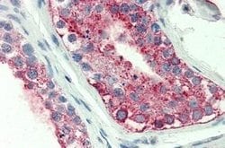 Invitrogen GPR18 Polyclonal Antibody 25 &mu;g | Buy Online | Invitrogen&trade; | Fisher Scientific