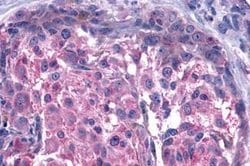 Invitrogen GPR15 Polyclonal Antibody 25 &mu;g | Buy Online | Invitrogen&trade; | Fisher Scientific